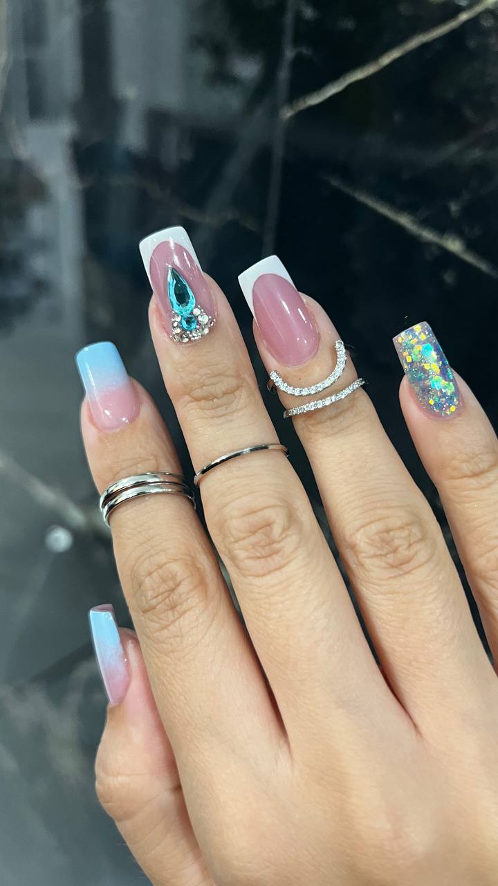 Ricostruzione Gel
